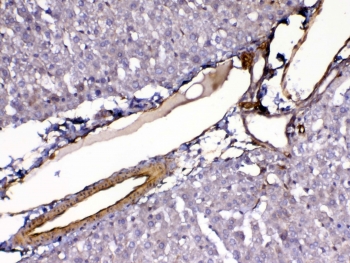 IHC testing of FFPE rat liver tissue with VEGFR3 antibody at 1ug/ml. Required HIER: steam section in pH6 citrate buffer for 20 min and allow to cool prior to testing.