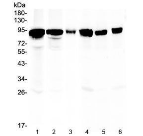 Western blot analysis of Periostin antibody in rat and mouse tissue lysates. Rat stomach (lane 1), rat lung (lane 2), rat NRK cells (lane 3), mouse heart (lane 4), mouse intestine (lane 5), and mouse lung (lane 6) lysates were probed with rabbit polyclonal Periostin antibody at 0.5 ug/ml. A prominent band is detected at approximately 90-100 kDa across multiple tissues, consistent with the predicted molecular weight of Periostin of approximately 93 kDa. The observed migration slightly above the predicted molecular weight is compatible with glycosylation and other post-translational modifications known for this secreted extracellular matrix protein.