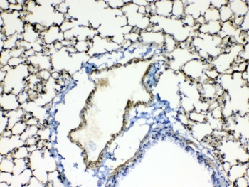 IHC testing of FFPE mouse lung tissue with Periostin antibody rabbit polyclonal at 1ug/ml. Required HIER: steam section in pH6 citrate buffer for 20 min and allow to cool prior to testing.