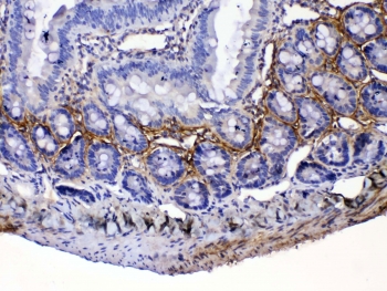 IHC testing of FFPE rat small intestine tissue with Periostin antibody rabbit polyclonal at 1ug/ml. Required HIER: steam section in pH6 citrate buffer for 20 min and allow to cool prior to testing.