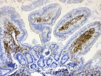 IHC testing of FFPE mouse intestine tissue with LYN antibody at 1ug/ml. Required HIER: steam section in pH6 citrate buffer for 20 min and allow to cool prior to testing.