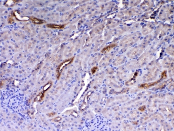 WFDC2 Antibody Rat Kidney IHC. Immunohistochemistry was performed on FFPE rat kidney tissue using WFDC2 Antibody at 1 ug/mL. Heat-induced epitope retrieval was performed by steaming tissue sections in pH 6 citrate buffer for 20 minutes followed by cooling prior to incubation with the primary antibody. Bound antibody was visualized using an HRP-conjugated secondary antibody and DAB chromogen. Distinct cytoplasmic staining is observed in renal tubular epithelial cells, while surrounding renal tissue exhibits minimal background staining. These results demonstrate that this WAP Four-Disulfide Core Domain Protein 2 Antibody is suitable for immunohistochemical detection of WFDC2 in formalin-fixed, paraffin-embedded rat tissue.