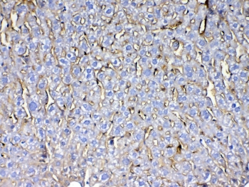 CD105 Antibody Mouse Liver IHC. Immunohistochemistry analysis of FFPE mouse liver tissue using CD105 Antibody demonstrates HRP-DAB brown membranous staining in endothelial cells outlining hepatic sinusoidal and vascular structures, consistent with Endoglin / CD105 expression in liver vasculature, supporting cross-species detection across mouse tissue types; nuclei are counterstained blue. HIER: steam sections in pH 6 citrate buffer for 20 min and allow to cool prior to testing.