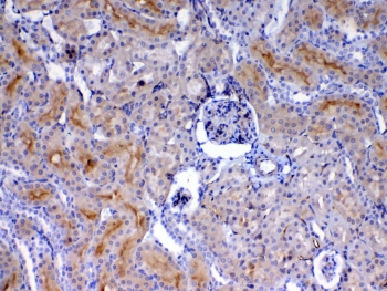 CD105 Antibody Rat Kidney IHC. Immunohistochemistry analysis of FFPE rat kidney tissue using CD105 Antibody demonstrates HRP-DAB brown membranous staining in endothelial cells lining glomerular and peritubular capillary structures, consistent with Endoglin / CD105 expression as an endothelial-associated protein, supporting cross-species detection in rat tissue; nuclei are counterstained blue. HIER: steam sections in pH 6 citrate buffer for 20 min and allow to cool prior to testing.