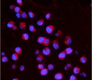 IL15RA Antibody Human K562 Cell IF. Immunofluorescent staining of FFPE human K562 cells using IL15RA Antibody. HIER was performed in pH 6 citrate buffer. A red fluorescent secondary antibody was used for detection, and nuclei were counterstained with DAPI (blue). IL15RA Antibody, an Immune Cell Activation Receptor Antibody, demonstrates predominantly cytoplasmic staining with membranous accentuation in K562 cells, consistent with the expected localization of IL15RA.