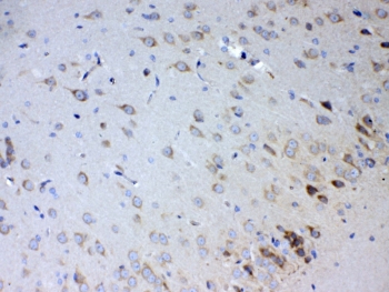 IL15RA Antibody Rat Brain IHC. Immunohistochemical staining of FFPE rat brain tissue using IL15RA Antibody at 1 ug/ml. HIER was performed in pH 6 citrate buffer. An HRP-conjugated secondary antibody with DAB substrate was used for detection. IL15RA Antibody, an Immune Cell Activation Receptor Antibody, demonstrates predominantly membranous and cytoplasmic staining of scattered cells throughout the brain tissue, consistent with the expected localization of IL15RA.