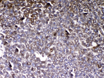 VDBP Antibody Mouse Liver IHC. Immunohistochemistry analysis of FFPE mouse liver tissue stained with VDBP antibody demonstrates diffuse granular cytoplasmic HRP-DAB brown staining throughout hepatocyte-associated cellular populations, consistent with the role of Vitamin D binding protein / VDBP as a major hepatic secretory and circulating transport protein involved in vitamin D metabolism and systemic endocrine homeostasis. The widespread staining profile aligns with the established liver-associated expression of this abundant serum carrier protein. Required HIER: steam tissue sections in pH 6 citrate buffer for 20 min and allow to cool prior to testing.