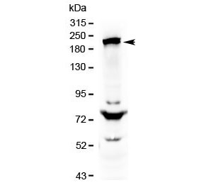 Western blot testing of human HepG2 cell lysate with CHD2 antibody at 0.5ug/ml. Predicted molecular weight ~211 kDa, commonly observed from 211-260 kDa.