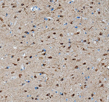 Immunohistochemistry analysis of SAP102/DLG3 expression in human brain tissue. Paraffin-embedded human brain sections were subjected to heat-mediated antigen retrieval in EDTA buffer (pH 8.0) and incubated with anti-SAP102/DLG3 antibody, followed by HRP-conjugated secondary antibody and DAB chromogen development. Brown staining is observed in neuronal cells, consistent with synapse-associated protein 102 localization, with hematoxylin nuclear counterstain (blue).