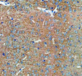 Immunohistochemistry analysis of SAP102/DLG3 expression in mouse brain tissue. Paraffin-embedded mouse brain sections were subjected to heat-mediated antigen retrieval in EDTA buffer (pH 8.0) and incubated with anti-SAP102/DLG3 antibody, followed by HRP-conjugated secondary antibody and DAB chromogen development. Brown immunoreactivity is observed in neuronal cells and surrounding neuropil, consistent with synapse-associated protein 102 distribution, with hematoxylin nuclear counterstain (blue).