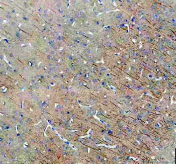 Immunohistochemistry analysis of SAP102/DLG3 expression in rat brain tissue. Paraffin-embedded rat brain sections were subjected to heat-mediated antigen retrieval in EDTA buffer (pH 8.0) and incubated with anti-SAP102/DLG3 antibody, followed by HRP-conjugated secondary antibody and DAB chromogen development. Brown staining is detected in neuronal cell bodies and processes, consistent with synapse-associated protein 102 localization, with hematoxylin nuclear counterstain (blue).