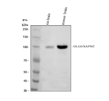 Western blot analysis of DLG3/SAP102 expression. Rat brain tissue lysate (lane 1) and mouse brain tissue lysate (lane 2) were separated by SDS-PAGE and probed with anti-DLG3/SAP102 antibody. A specific immunoreactive band is detected at approximately 100 kDa in both samples, corresponding to DLG3/SAP102. The predicted molecular weight of DLG3/SAP102 based on amino acid sequence is approximately 90 kDa; the observed higher apparent molecular weight is consistent with known properties of MAGUK scaffold proteins, which often exhibit slower migration on SDS-PAGE due to their extended domain structure and post-translational modifications.