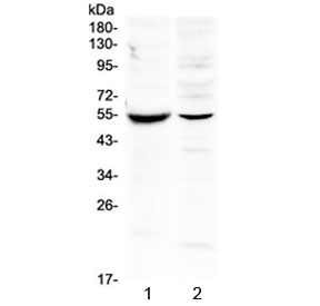 Western blot testing of 1) mouse intestine and 2) human SMMC-7721 lysate with MMP16 antibody at 0.5ug/ml. Predicted molecular weight: ~70 kDa (long form), ~53 kDa (short form).