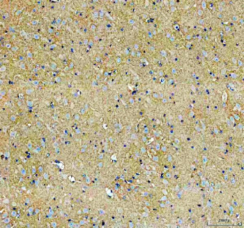 Immunohistochemical staining of FFPE rat brain tissue with TCP1 antibody, HRP-secondary and DAB substrate. HIER: boil tissue sections in pH8 EDTA for 20 min and allow to cool before testing.