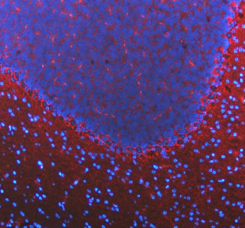 Immunofluorescent staining of FFPE mouse cerebellum tissue with GAT-1 antibody (red) and DAPI nuclear stain (blue). HIER: steam section in pH8 EDTA buffer for 20 min.