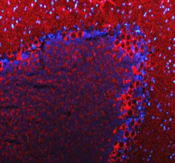 Immunofluorescent staining of FFPE rat cerebellum tissue with GAT-1 antibody (red) and DAPI nuclear stain (blue). HIER: steam section in pH8 EDTA buffer for 20 min.