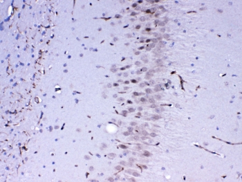 IHC testing of FFPE mouse brain tissue with MED4 antibody at 1ug/ml. Required HIER: steam section in pH6 citrate buffer for 20 min and allow to cool prior to testing.