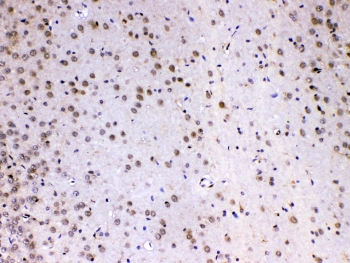 IHC testing of FFPE rat brain tissue with MED4 antibody at 1ug/ml. Required HIER: steam section in pH6 citrate buffer for 20 min and allow to cool prior to testing.