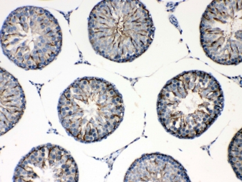 IHC testing of FFPE rat testis tissue with Formin antibody at 1ug/ml. Required HIER: steam section in pH6 citrate buffer for 20 min and allow to cool prior to testing.