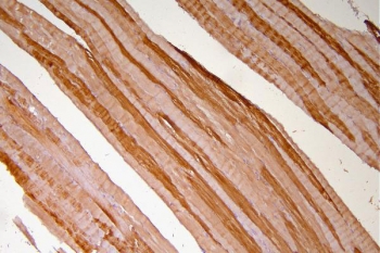 IHC staining of FFPE human skeletal muscle with HSP20 antibody. HIER: boil tissue sections in pH8 EDTA for 20 min and allow to cool before testing.