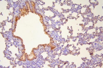IHC staining of FFPE rat lung with HSP20 antibody. HIER: boil tissue sections in pH8 EDTA for 20 min and allow to cool before testing.