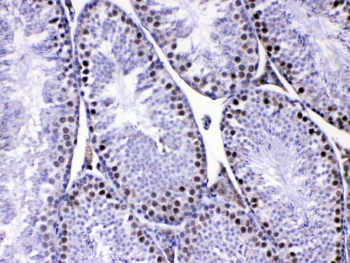 IHC testing of FFPE mouse testis tissue with MED8 antibody at 1ug/ml. Required HIER: steam section in pH6 citrate buffer for 20 min and allow to cool prior to testing.