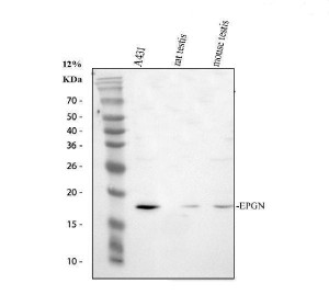 Epigen Antibody Human Cell and Rodent Testis WB. Western blot analysis was performed under reducing conditions using 30 ug of lysate per lane. Lane 1: human A431 cells; Lane 2: rat testis tissue; Lane 3: mouse testis tissue. The membrane was incubated overnight at 4Â°C with rabbit anti-Epigen antibody at 0.5 ug/ml, followed by an HRP-conjugated goat anti-rabbit IgG secondary antibody and ECL detection. A specific band was observed at approximately 17 kDa in all three samples, matching the expected molecular weight of Epigen. Epigen Antibody, an epithelial mitogen antibody, supports analysis of EPGN expression in human, rat and mouse samples.