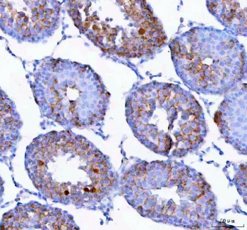 EPGN Antibody Rat Testis IHC. Epigen was detected in a formalin-fixed, paraffin-embedded section of rat testis tissue. Heat-induced epitope retrieval was performed by boiling the section in EDTA buffer, pH 8.0, for 20 minutes followed by cooling before staining. Brown chromogenic signal is visible within the seminiferous tubules, with prominent cytoplasmic staining in populations of developing germ cells and comparatively limited interstitial staining. This EPGN Antibody, also described as an EGFR Ligand Epigen Antibody, supports studies of Epigen distribution and growth factor signaling in rat reproductive tissue.