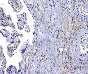 CD44 Antibody Placenta IHC. Immunohistochemistry analysis of CD44 / CD44 antigen expression in FFPE human placental tissue using rabbit polyclonal antibody at 1 ug/ml. Membranous HRP-DAB brown staining is observed in trophoblast and stromal-associated cells, highlighting cell surface localization consistent with CD44 expression. The staining pattern demonstrates regional variation between villous structures and stromal compartments and supports its use for evaluating CD44 distribution and cellular organization in placental tissue. Heat induced epitope retrieval was performed by steaming tissue sections in pH 6 citrate buffer for 20 min followed by cooling prior to testing.