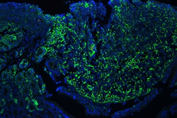 GNB1 Antibody Mouse Lymph Tissue IF. Immunofluorescence analysis of GNB1 expression in FFPE mouse lymph tissue using antibody at 1 ug/ml (green) with DAPI nuclear stain (blue). Strong cytoplasmic fluorescence is observed in densely packed lymphoid cell populations, with signal distributed throughout the tissue and highlighting cellular architecture within lymphoid regions. The staining pattern supports GNB1 localization in immune cell-rich environments and is consistent with its role in intracellular signaling. Heat induced epitope retrieval was performed by steaming tissue sections in pH 6 citrate buffer for 20 min.