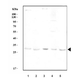 IL6 Antibody Spleen and Macrophage Cell Line WB. Western blot analysis of 1) rat spleen, 2) mouse spleen, 3) mouse ANA-1, 4) mouse RAW264.7, and 5) mouse EL-4 cell lysates using IL6 Antibody / Interleukin-6 Antibody demonstrates a distinct band at approximately 24 kDa across multiple immune-related tissues and cell lines, consistent with the expected molecular weight of Interleukin 6. IL6 is a key pro-inflammatory cytokine produced by activated immune cells and plays an important role in cytokine signaling, innate immune responses, lymphocyte activation, and regulation of inflammatory microenvironments. Detection in splenic tissue and established immune cell models supports the utility of this antibody for studies of inflammation, immunology, cytokine biology, and immune-mediated disease mechanisms. Predicted molecular weight: ~24 kDa, though higher molecular weight forms may be observed due to glycosylation.