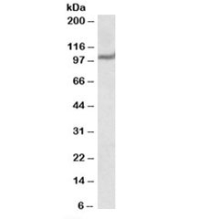 Western blot testing of human heart lysate with USP4 antibody at 1ug/ml. Predicted molecular weight: 104kDa.