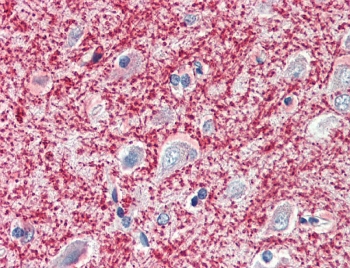 IHC testing of FFPE human cerebral cortex tissue with MOG antibody at 5ug/ml. Steamed antigen retrieval with citrate buffer pH 6, AP-staining.