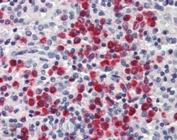 IHC staining of FFPE human spleen with Lipocalin 2 antibody at 2.5ug/ml. HIER: steamed with pH6 citrate buffer, AP-staining.