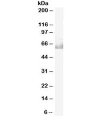 CDT1 Antibody Human Ovary WB. Western blot analysis of human ovary lysate using CDT1 antibody demonstrates detection of a band at approximately 60-70 kDa, consistent with the expected molecular weight of Chromatin Licensing and DNA Replication Factor 1 (CDT1). CDT1 is a DNA replication licensing factor that regulates pre-replication complex assembly and ensures accurate genome duplication during cell cycle progression. Expression of CDT1 is associated with proliferating cell populations and reflects its essential role in cellular proliferation, chromosome maintenance, and genome stability. Western blot was performed using 0.05 ug/ml primary antibody. Predicted molecular weight: ~60 kDa, commonly observed at 60-70 kDa.