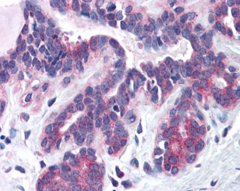 IHC testing of FFPE human breast tissue with SNX16 antibody at 3.75ug/ml. Required HIER: steamed antigen retrieval with pH6 citrate buffer; AP-staining.