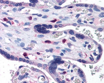 IHC testing of FFPE human placental tissue with SNX16 antibody at 3.75ug/ml. Required HIER: steamed antigen retrieval with pH6 citrate buffer; AP-staining.