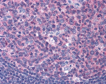 IHC testing of FFPE human tonsil tissue with SNX16 antibody at 3.75ug/ml. Required HIER: steamed antigen retrieval with pH6 citrate buffer; AP-staining.