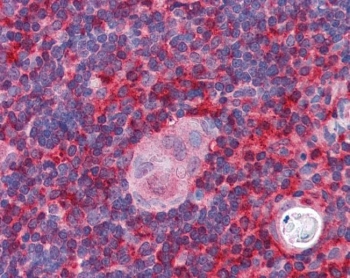 IHC testing of FFPE human thymus tissue with ARPC1B antibody at 5ug/ml. Required HIER: steamed antigen retrieval with pH6 citrate buffer; AP-staining.