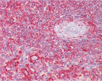 IHC testing of FFPE human spleen tissue with Clatherin Light Chain antibody at 2.5ug/ml. Required HIER: steamed antigen retrieval with pH6 citrate buffer; AP-staining.