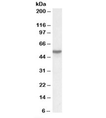 Vitamin D-binding protein Antibody Lung WB. Western blot testing of lung lysate with Vitamin D-binding protein antibody at 0.03ug/ml. Predicted molecular weight: ~53kDa.