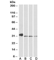 NIMA Related Kinase 7 Antibody Rat and Mouse Tissue WB. Western blot testing of mouse lung, mouse testis, rat lung and rat testis tissue lysates with NIMA Related Kinase 7 Antibody at 0.3 ug/ml. Lane A: mouse lung; Lane B: mouse testis; Lane C: rat lung; Lane D: rat testis. Predicted molecular weight: ~34 kDa. NIMA Related Kinase 7 Antibody / Cell Cycle Kinase Antibody detects endogenous NEK7 expression and supports studies of mitotic regulation, kinase signaling, centrosome function and cell cycle control pathways.