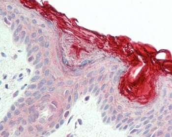 IHC testing of FFPE human skin tissue with PERP antibody at 5ug/ml. Required HIER: steamed antigen retrieval with pH6 citrate buffer; AP-staining.