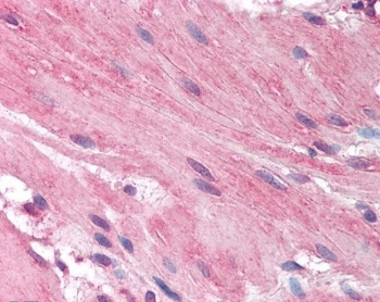 IHC testing of FFPE human small intestine with HRH1 antibody at 5ug/ml. HIER: steamed antigen retrieval with pH6 citrate buffer; AP-staining.