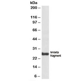 PMEL17 Antibody Goat Polyclonal. Western blot analysis of human skin lysate using PMEL17 Antibody Goat Polyclonal. A band is detected at approximately 26 kDa, consistent with the M-beta fragment derived from proteolytic processing of Premelanosome protein PMEL, also known as gp100. PMEL is synthesized as an approximately 70 kDa precursor that can appear near approximately 100 kDa when glycosylated and is subsequently cleaved into multiple fragments including the approximately 26 kDa M-beta fragment that contributes to formation of the fibrillar matrix within melanosomes in melanocytic cells.
