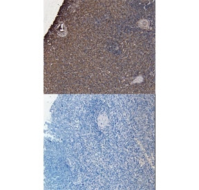 IHC staining of FFPE human tonsil with CD20 antibody at 7ug/ml. HIER: steamed with pH6 citrate buffer, HRP-staining.
