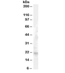 FGF21 Antibody Liver WB. Western blot testing of human liver lysate with FGF21 antibody at 1ug/ml. Predicted molecular weight ~21 kDa.