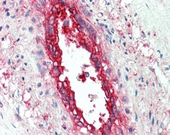 IHC testing of FFPE human vessel with EHD2 antibody at ug/ml. HIER: steamed antigen retrieval with pH6 citrate buffer; AP-staining.