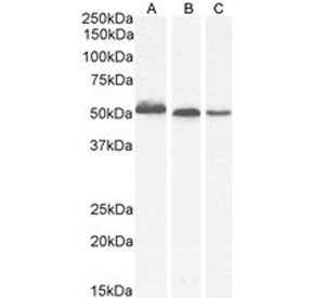 Western blot of 1A) human thyroid, 2) mouse brain and 3) rat brain tissue lysate probed with AKT3 antibody. Predicted molecular weight: ~56 kDa but can be observed from 60~65 kDa.