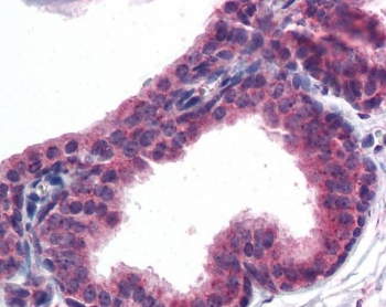 IHC testing of FFPE human prostate tissue with AKT3 antibody at 5ug/ml. Required HIER: steamed antigen retrieval with pH6 citrate buffer; AP-staining.